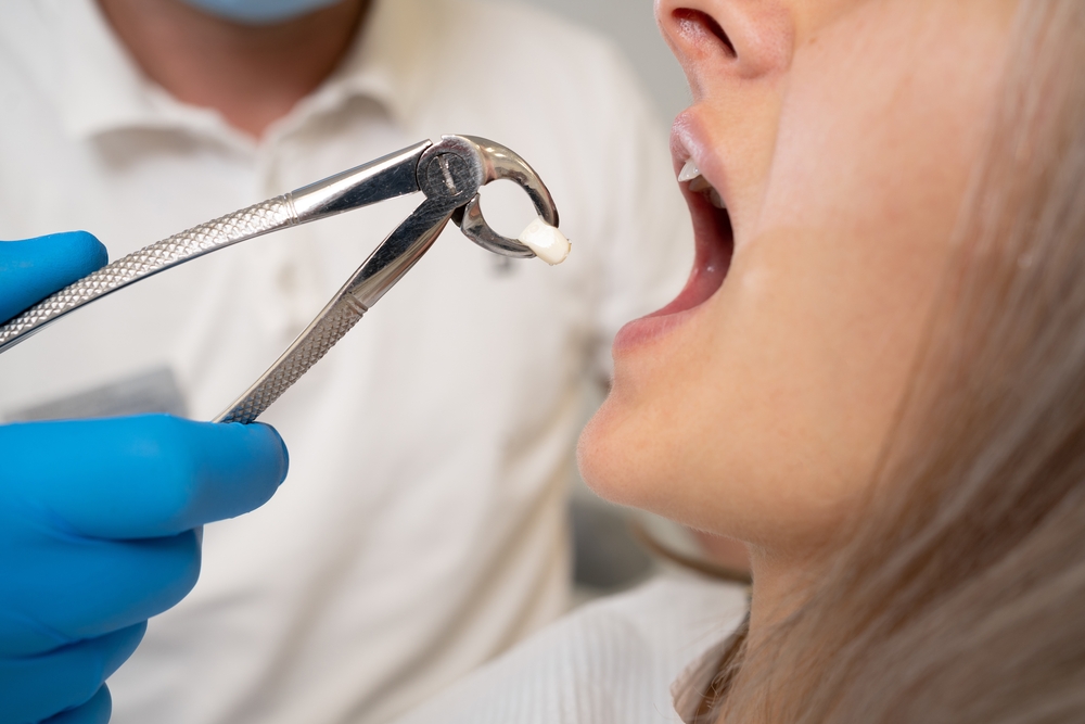 Is It Safe to Get a Tooth Pulled at a General Dental Clinic?