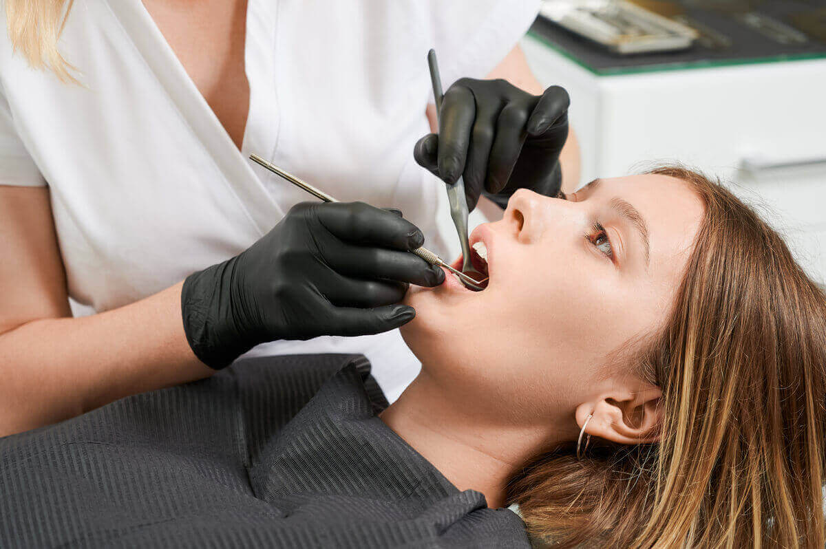 what foods to avoid with composite Fillings