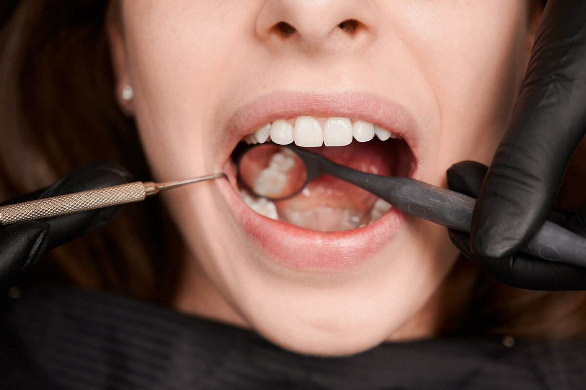what is worse getting a root canal or getting a tooth pulled